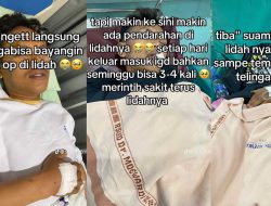 Sariawan Tak Kunjung Sembuh Selama 2 Tahun, Pria di Solo Ternyata Alami Kanker Lidah